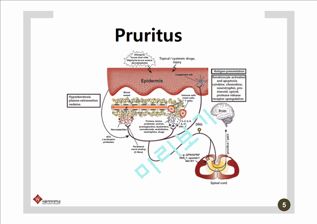 Pathophysiology and therapy of pruritus in allergic and atopic diseases   (5 )